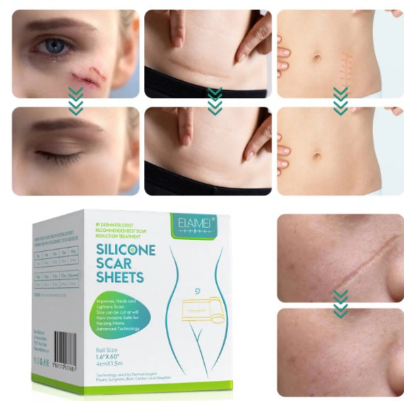 Elaimei DermiCare Silicone Scar Tape Your Solution for Scar Management and Stretch Marks Treatment